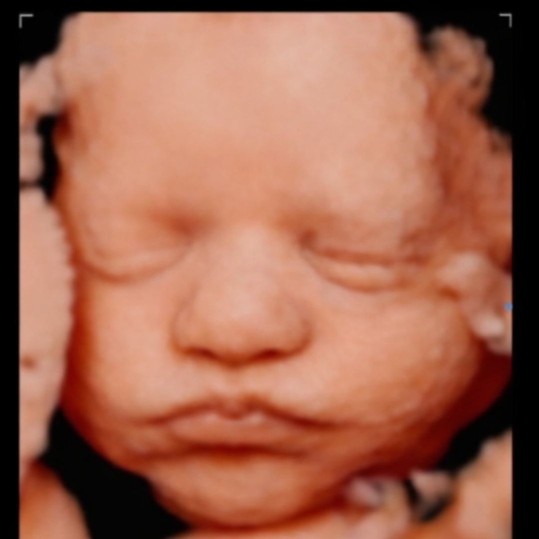 Photo shared by Angela for their Babylist baby registry.