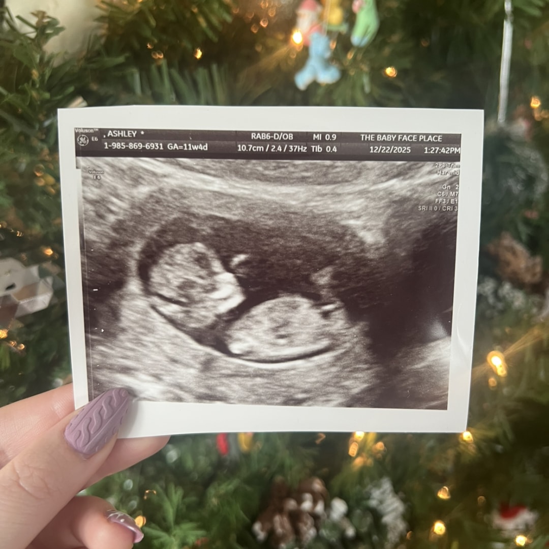 Photo shared by Ashley for their Babylist baby registry.