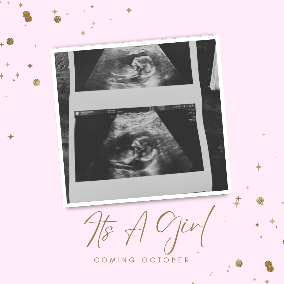 Photo shared by Cheyenne for their Babylist baby registry.
