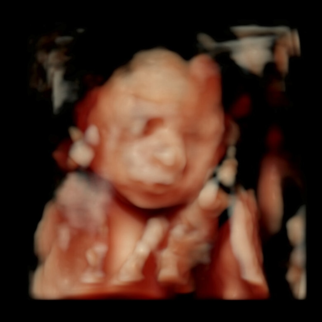 Photo shared by Alexandria for their Babylist baby registry.