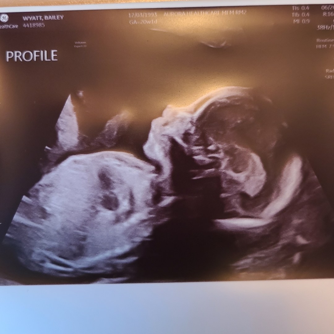 Photo shared by Bailey for their Babylist baby registry.