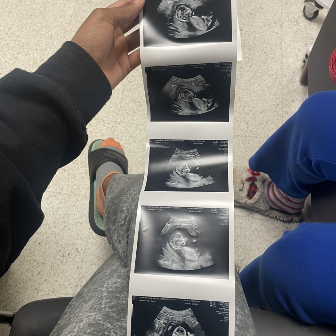 Photo shared by Makayla for their Babylist baby registry.