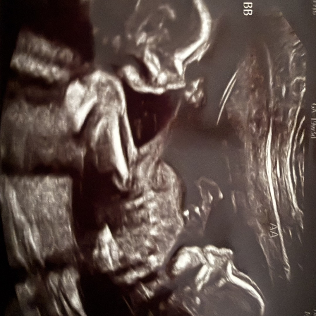 Photo shared by Nicole Lynn for their Babylist baby registry.