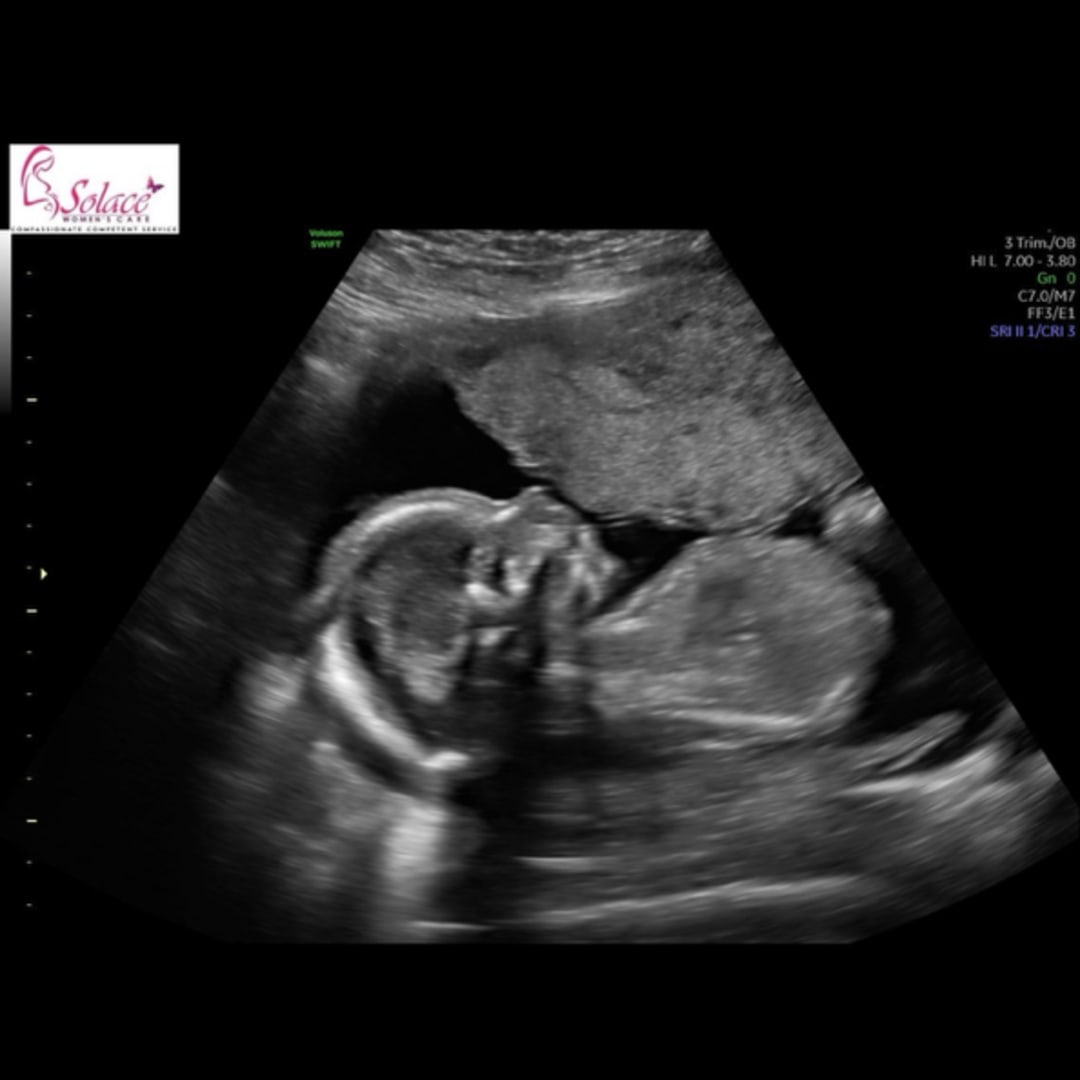 Photo shared by Sidney for their Babylist baby registry.