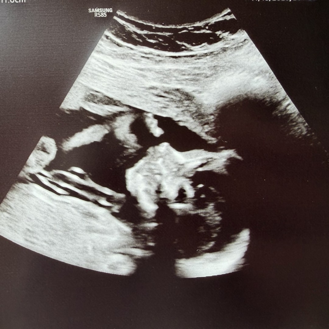 Photo shared by Carley for their Babylist baby registry.