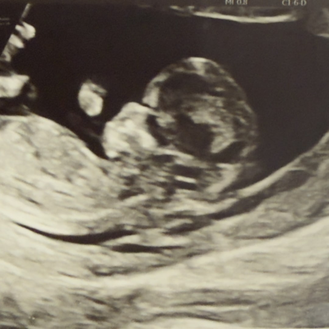 Photo shared by Abigaëlle for their Babylist baby registry.