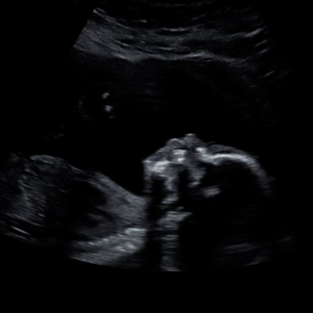 Photo shared by Katherine for their Babylist baby registry.