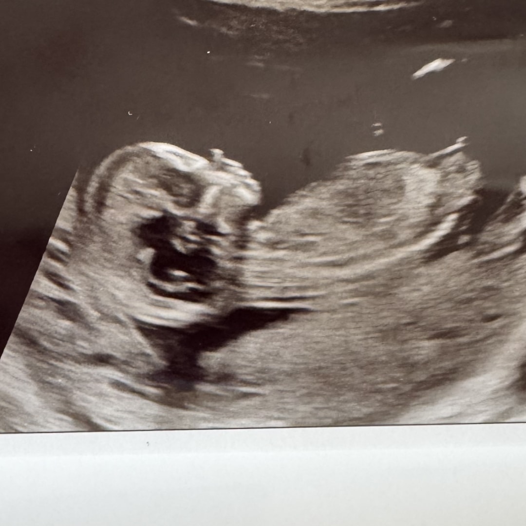 Photo shared by Amber for their Babylist baby registry.
