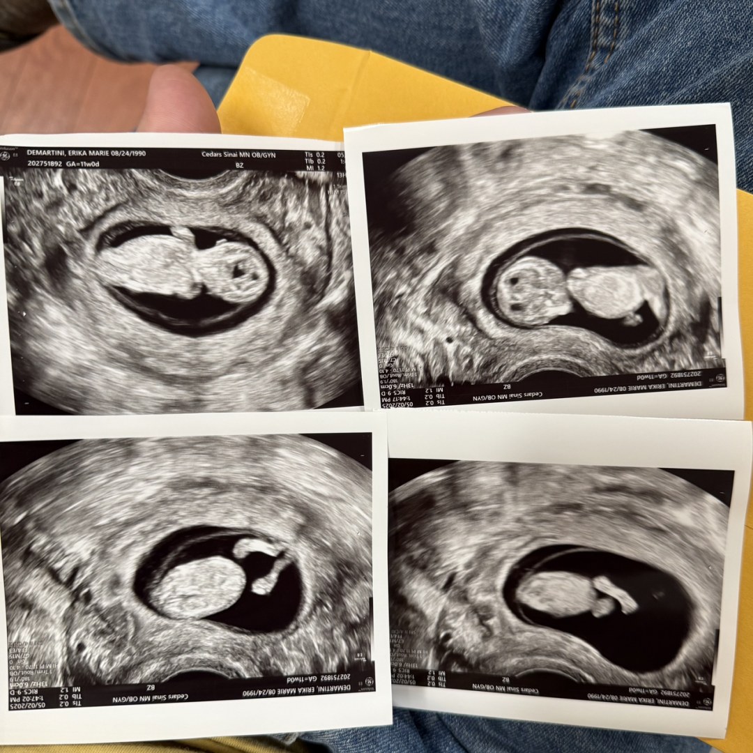 Photo shared by Erika for their Babylist baby registry.