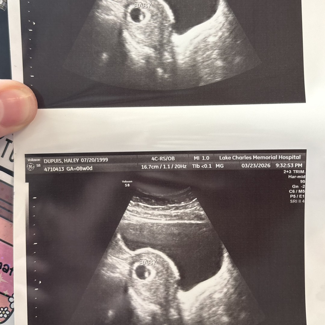 Photo shared by Haley for their Babylist baby registry.