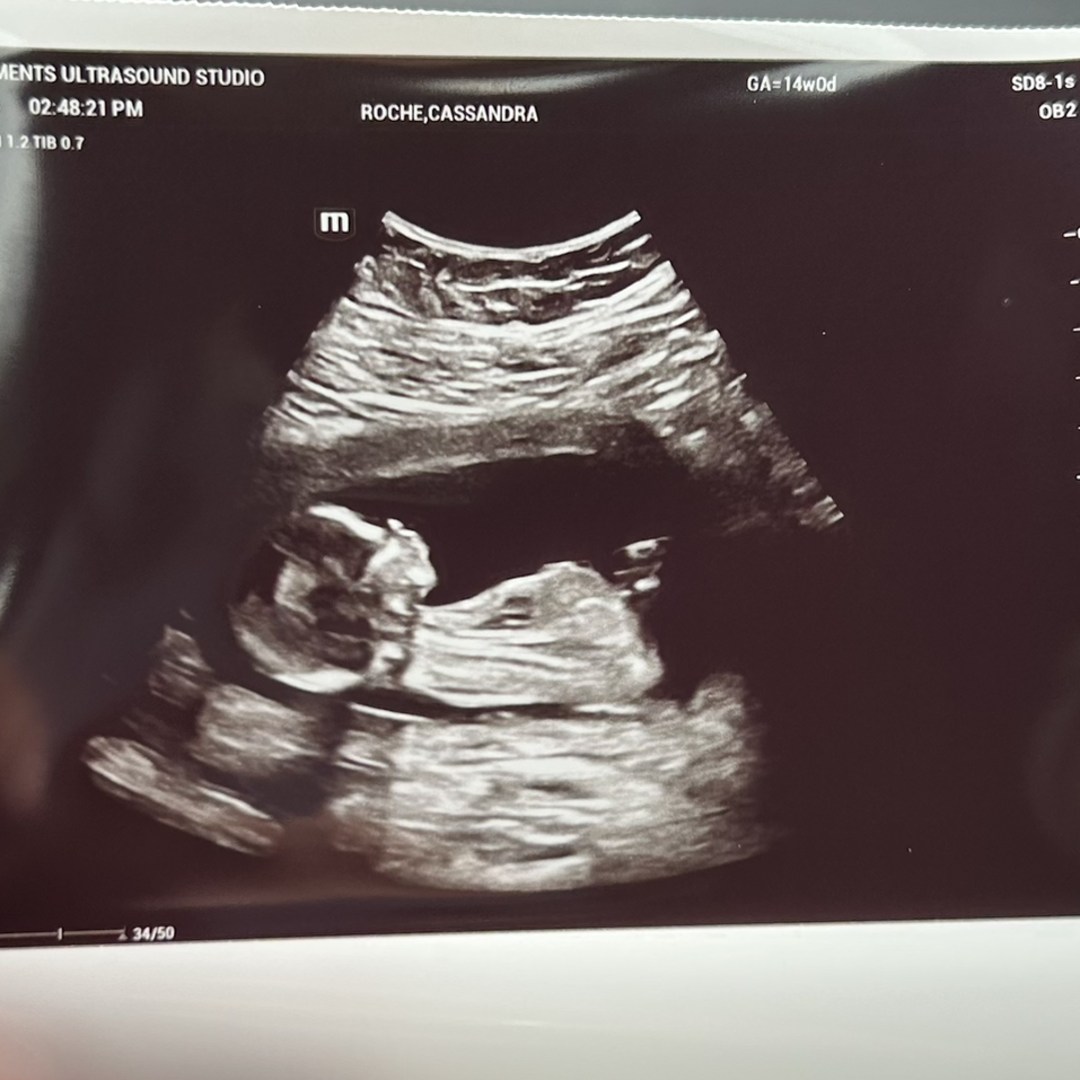 Photo shared by Cassandra for their Babylist baby registry.