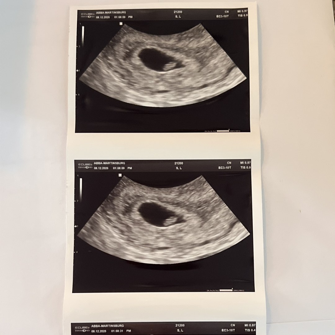 Photo shared by Levin for their Babylist baby registry.