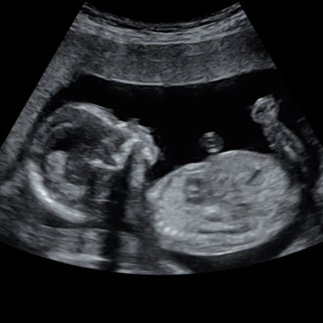 Photo shared by Angelica for their Babylist baby registry.