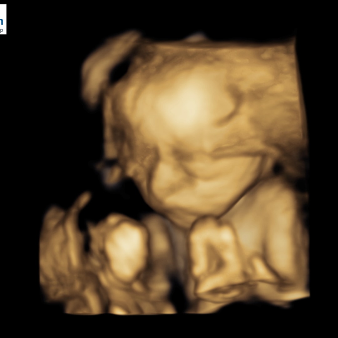 Photo shared by Natali for their Babylist baby registry.