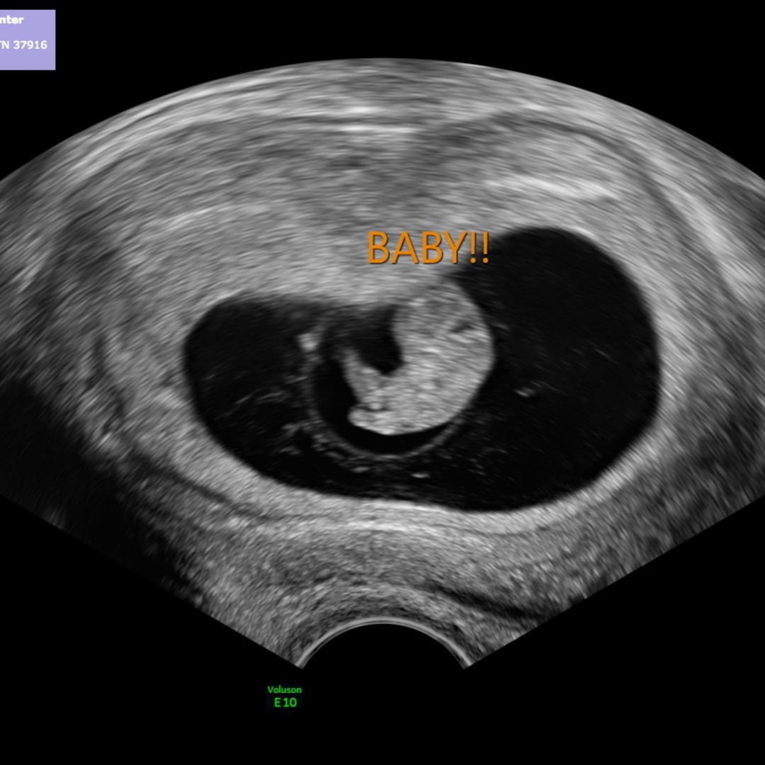 Photo shared by Savannah for their Babylist baby registry.