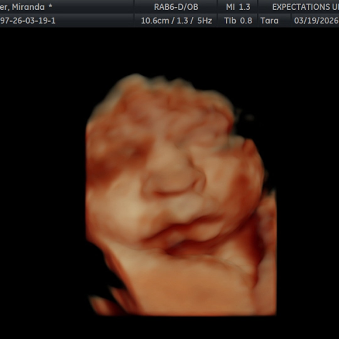 Photo shared by Miranda for their Babylist baby registry.