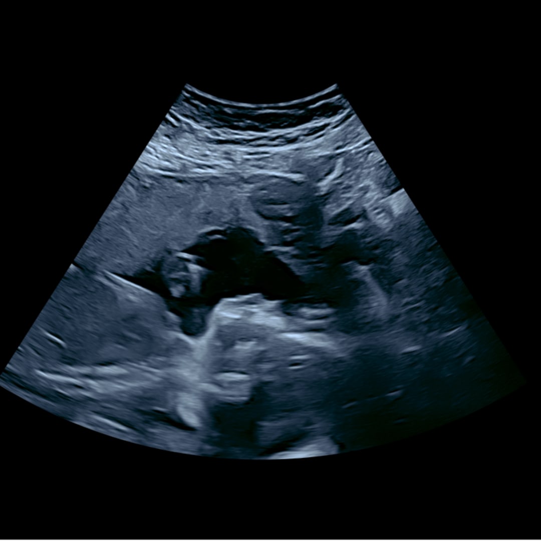 Photo shared by Ashleigh for their Babylist baby registry.