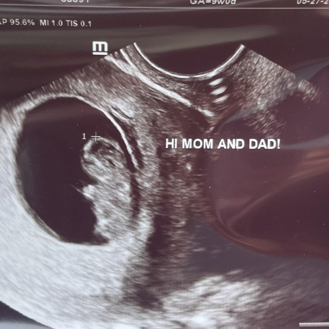 Photo shared by Danielle for their Babylist baby registry.