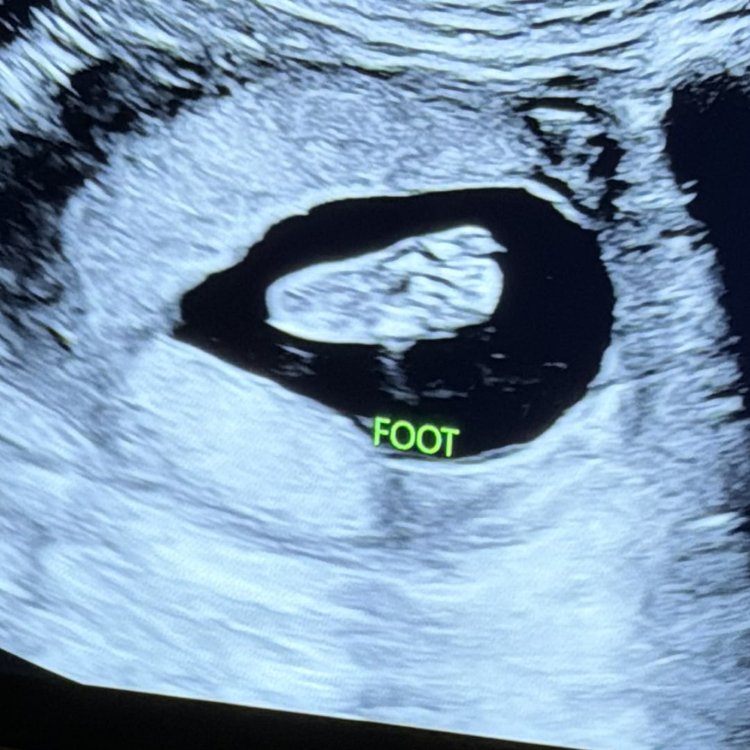 Photo shared by Anna Katherynn for their Babylist baby registry.