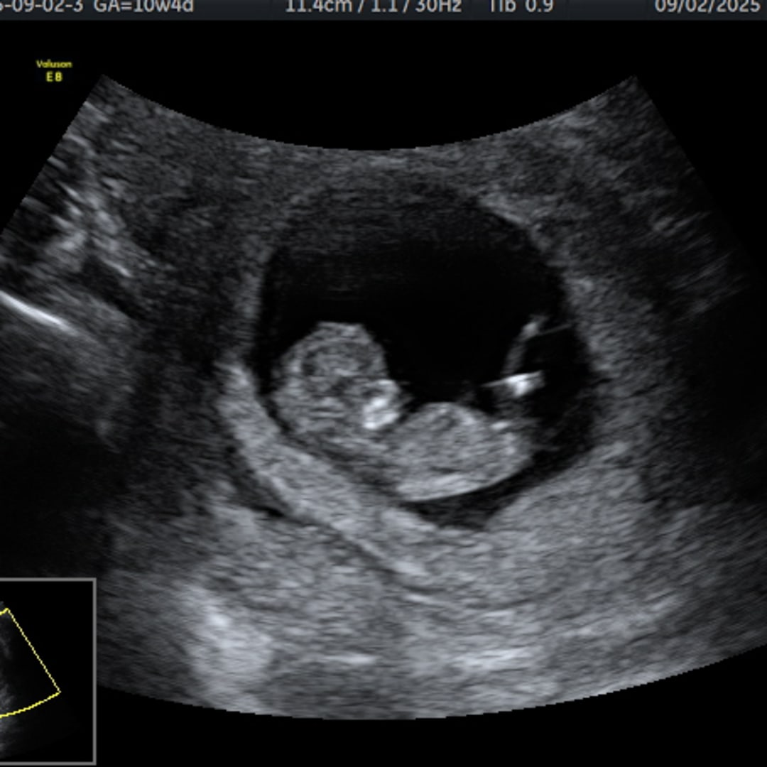 Photo shared by Kristen for their Babylist baby registry.