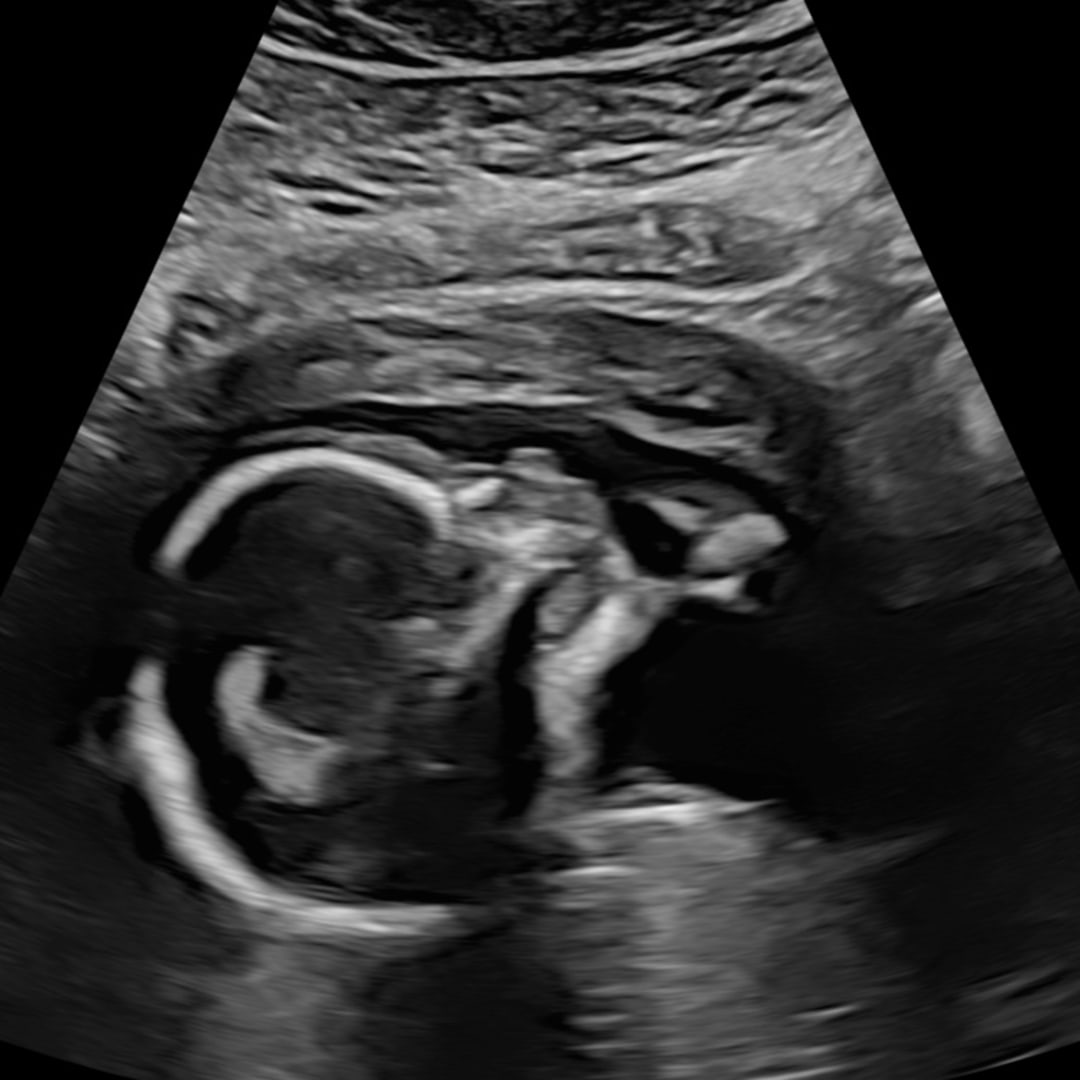 Photo shared by Bailey for their Babylist baby registry.