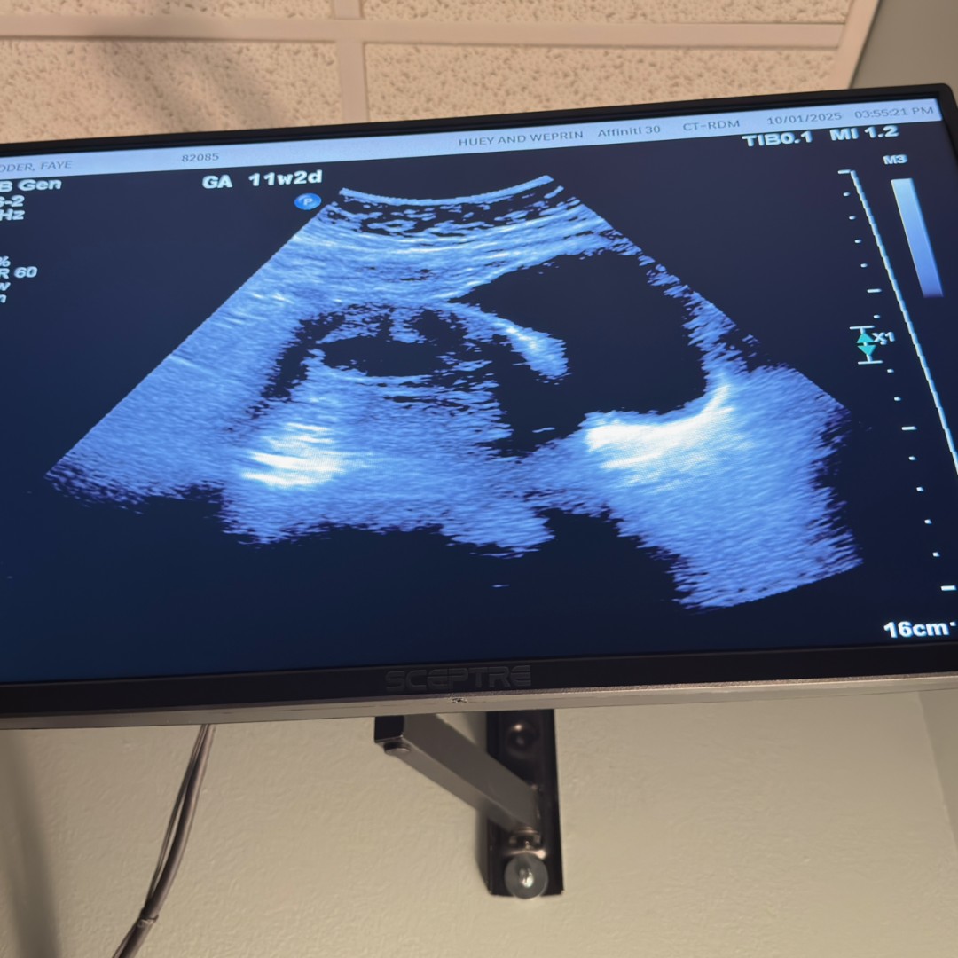 Photo shared by Faye Loraine for their Babylist baby registry.