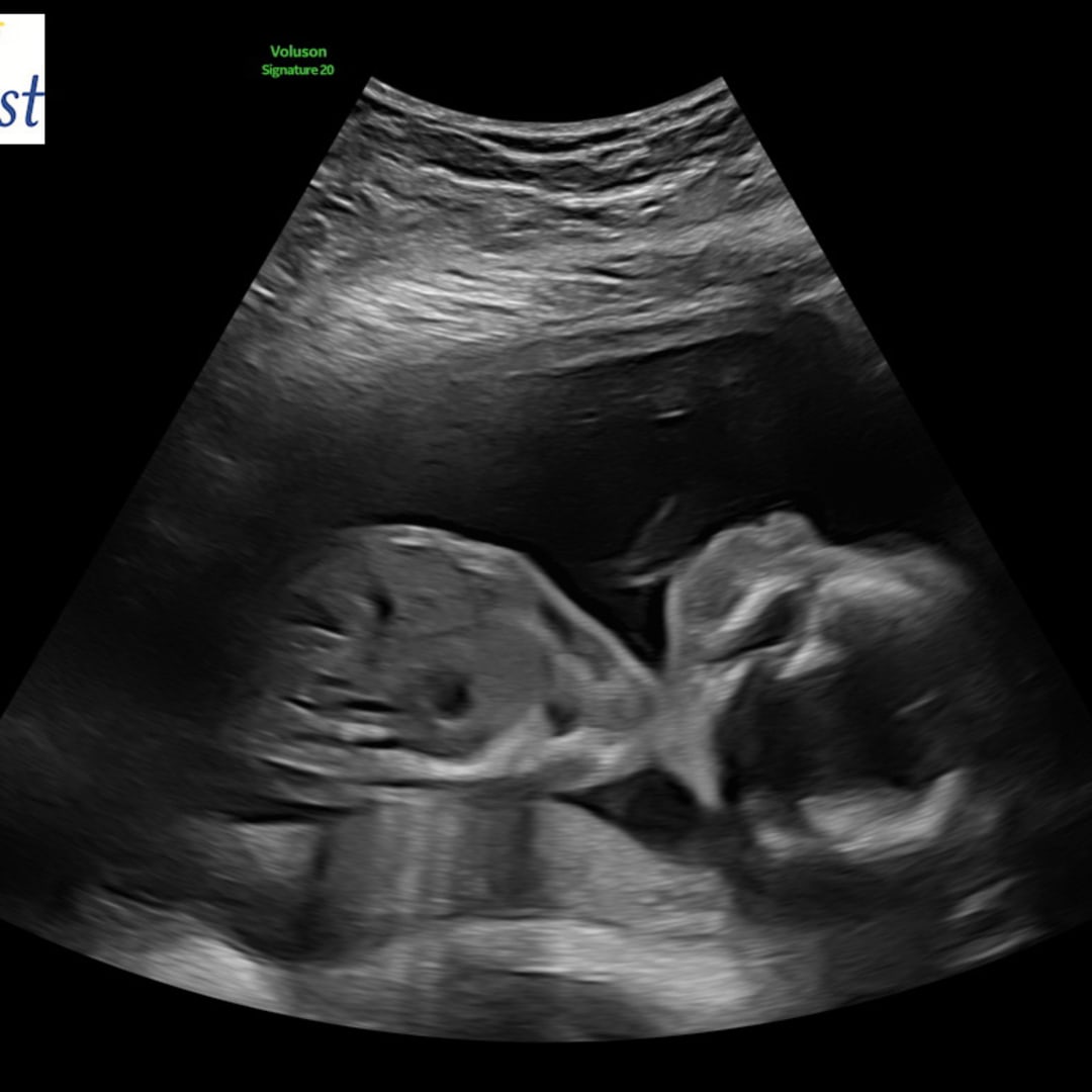 Photo shared by Bailey for their Babylist baby registry.