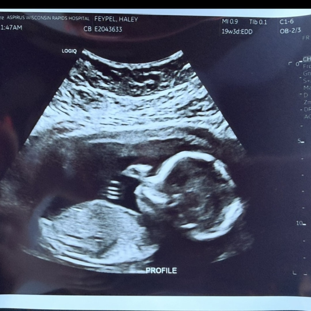 Photo shared by Haley for their Babylist baby registry.