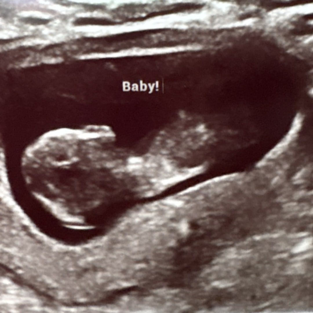 Photo shared by Isabelle for their Babylist baby registry.
