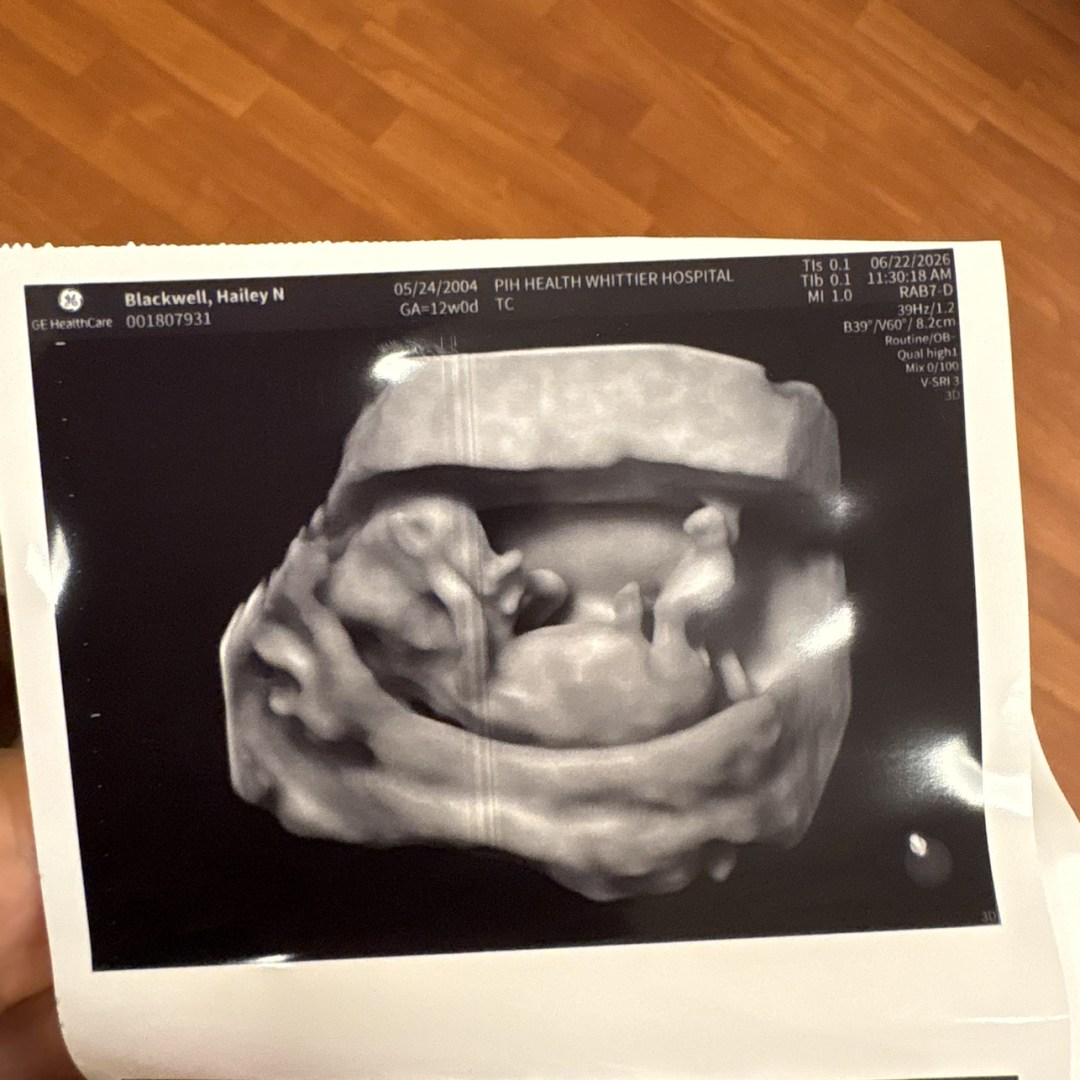 Photo shared by Hailey for their Babylist baby registry.