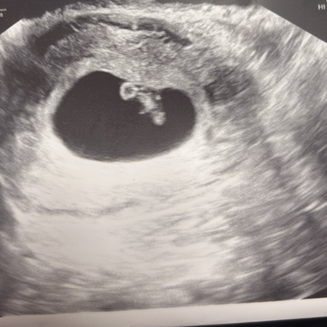 Photo shared by Lexie for their Babylist baby registry.