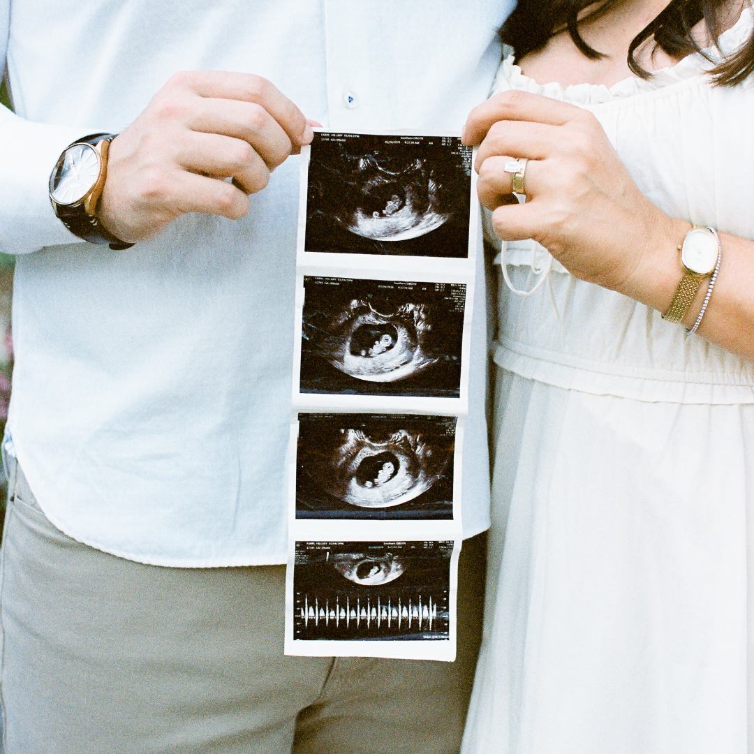Photo shared by Hillary for their Babylist baby registry.