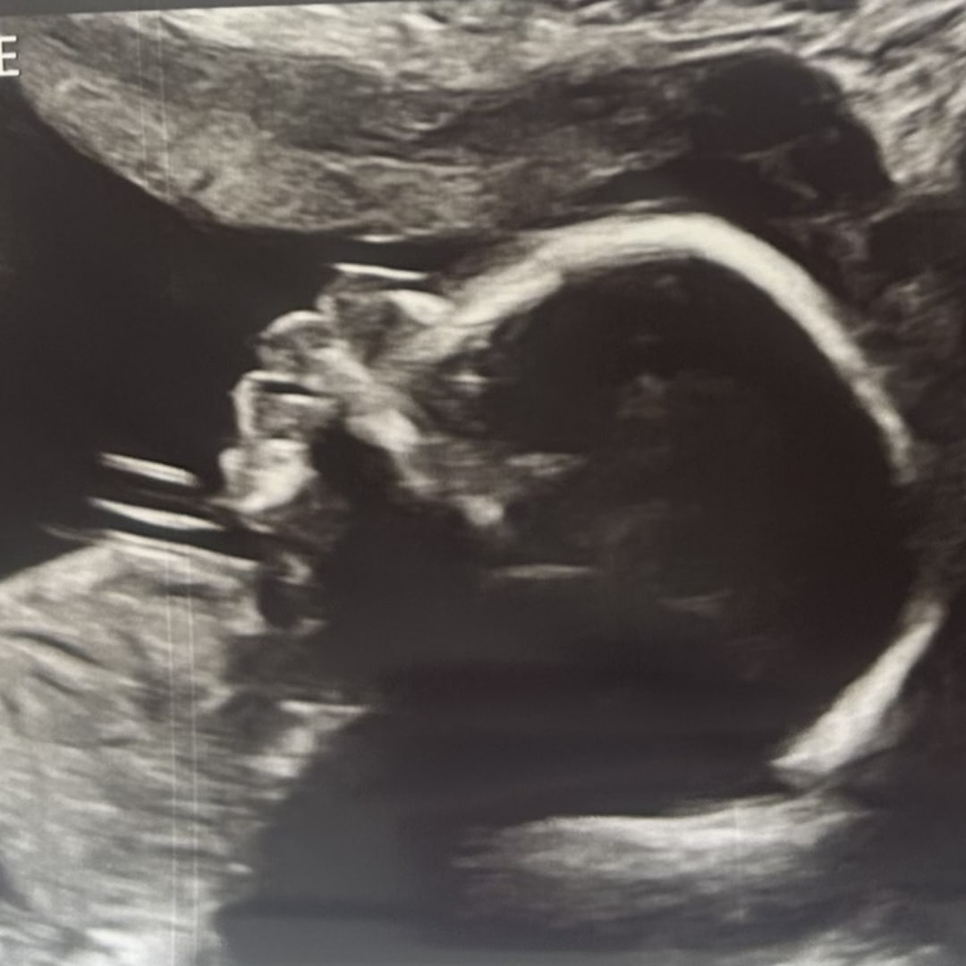 Photo shared by Rodlyn for their Babylist baby registry.