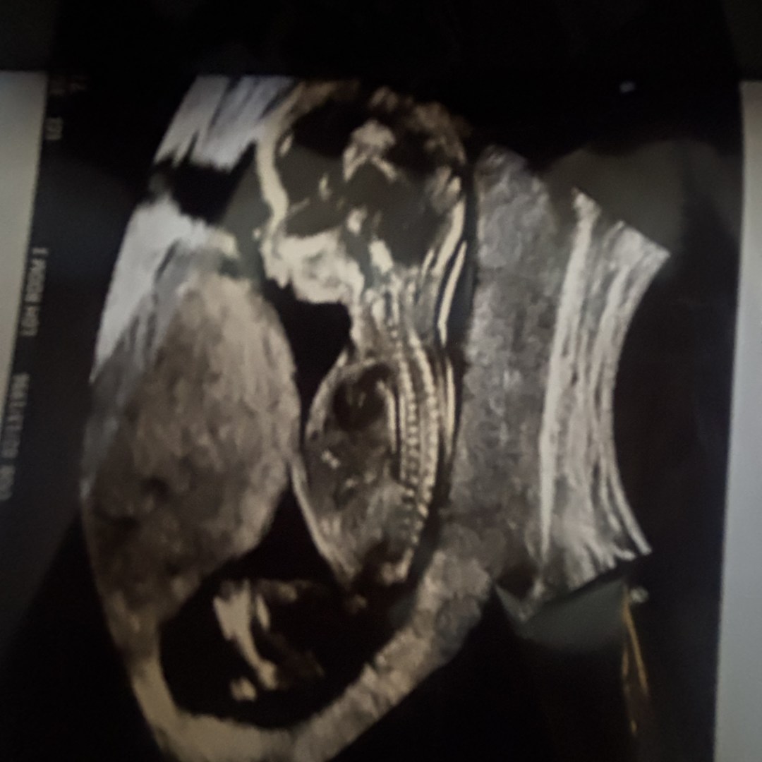 Photo shared by Andy and Alexa for their Babylist baby registry.
