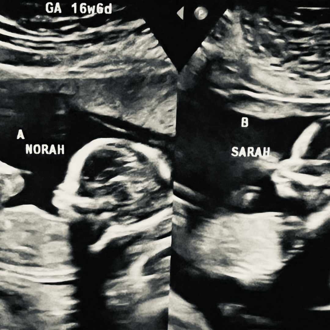 Photo shared by Alyssa for their Babylist baby registry.