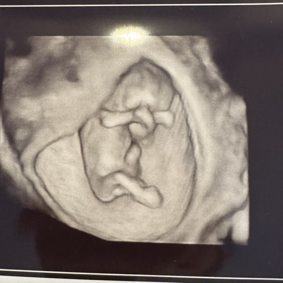 Photo shared by Makayla for their Babylist baby registry.