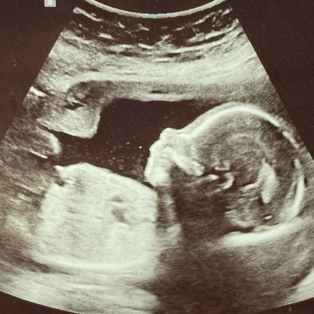 Photo shared by Teresa for their Babylist baby registry.