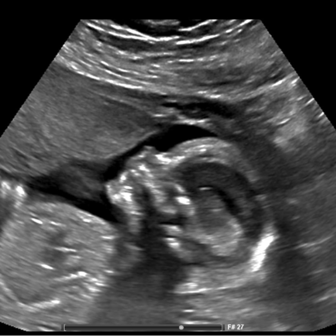 Photo shared by Erica for their Babylist baby registry.