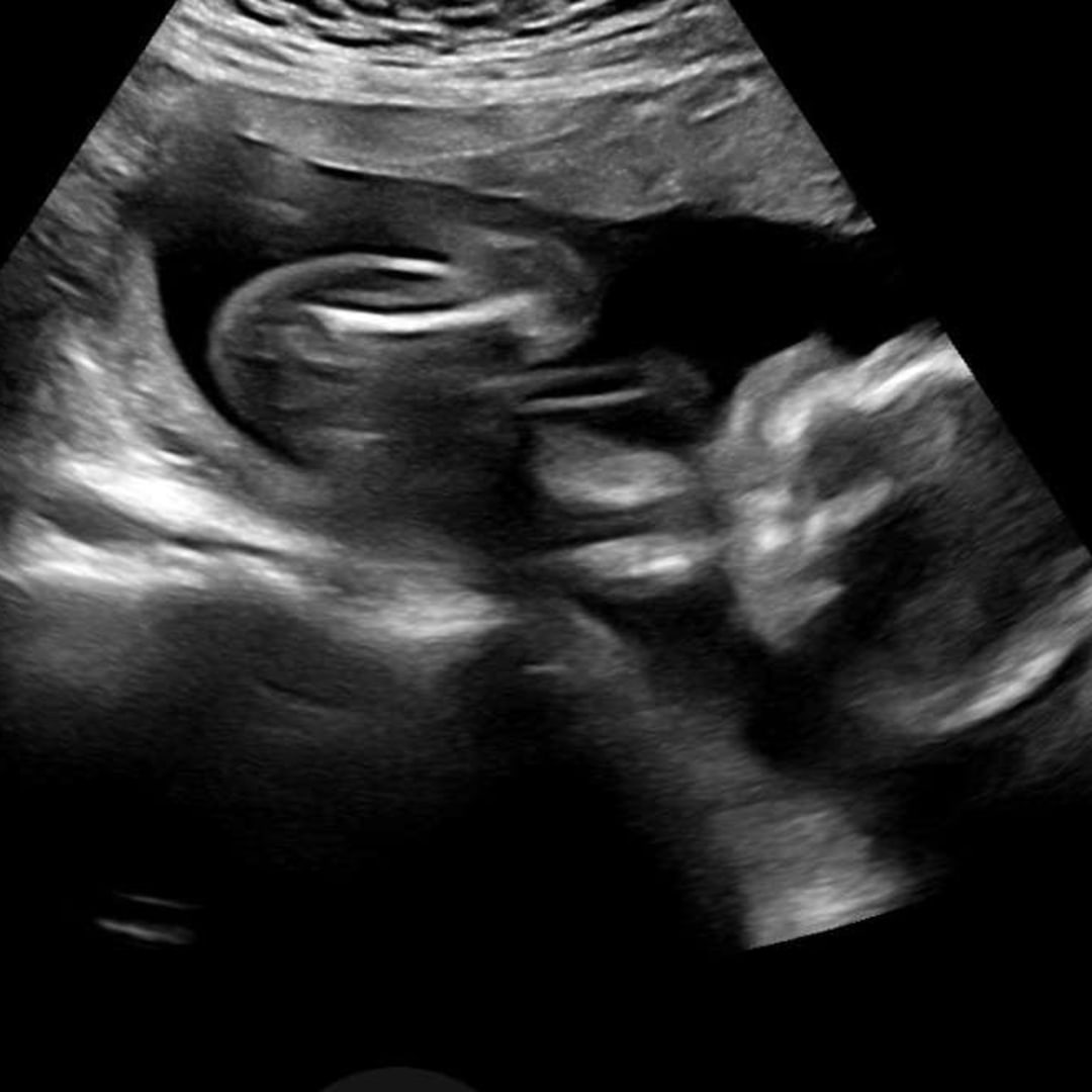 Photo shared by Erin for their Babylist baby registry.