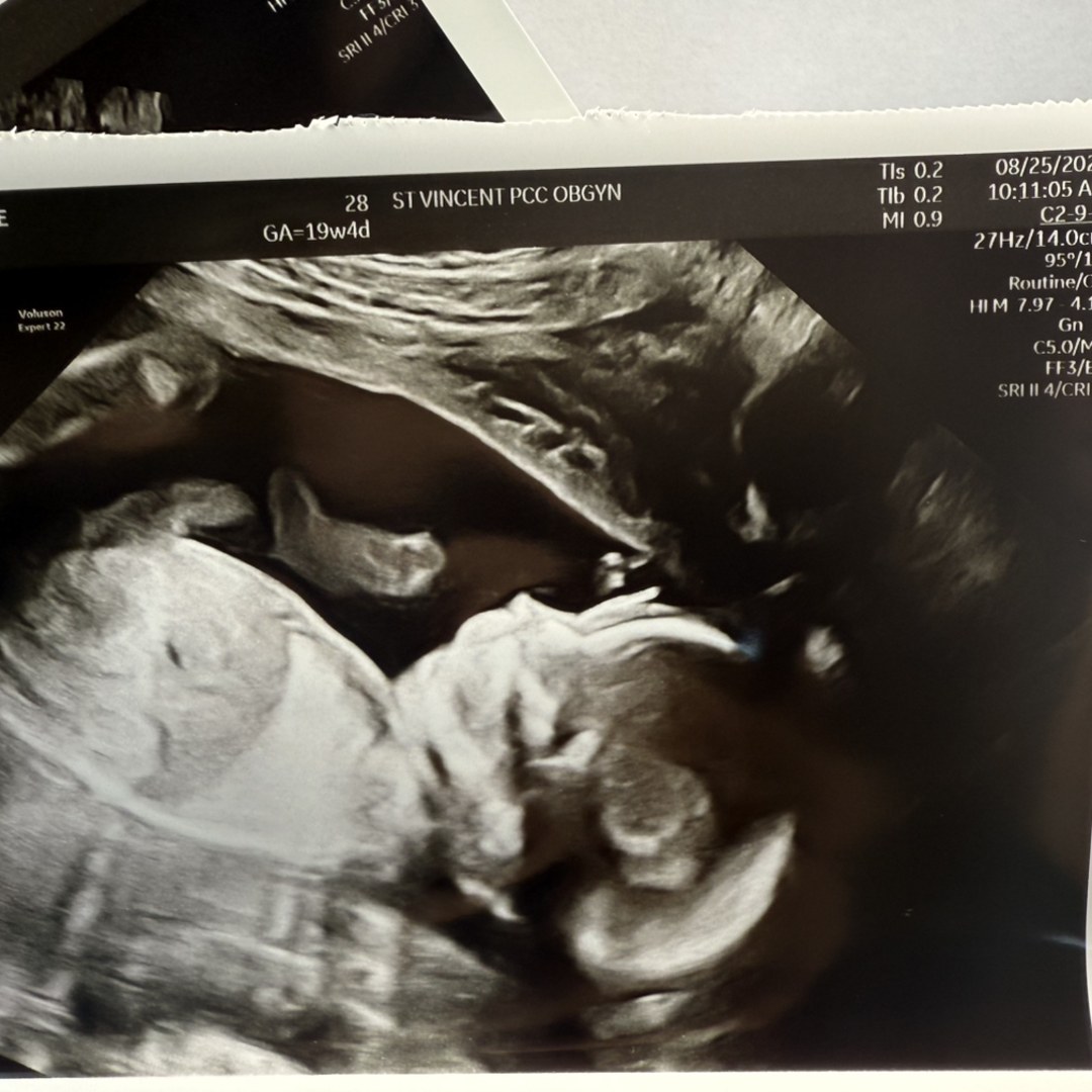 Photo shared by Alice for their Babylist baby registry.