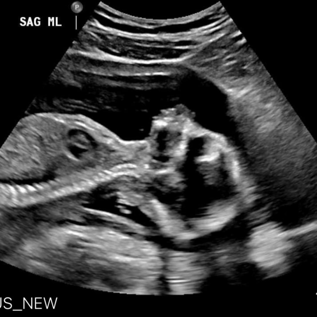 Photo shared by Hannah for their Babylist baby registry.
