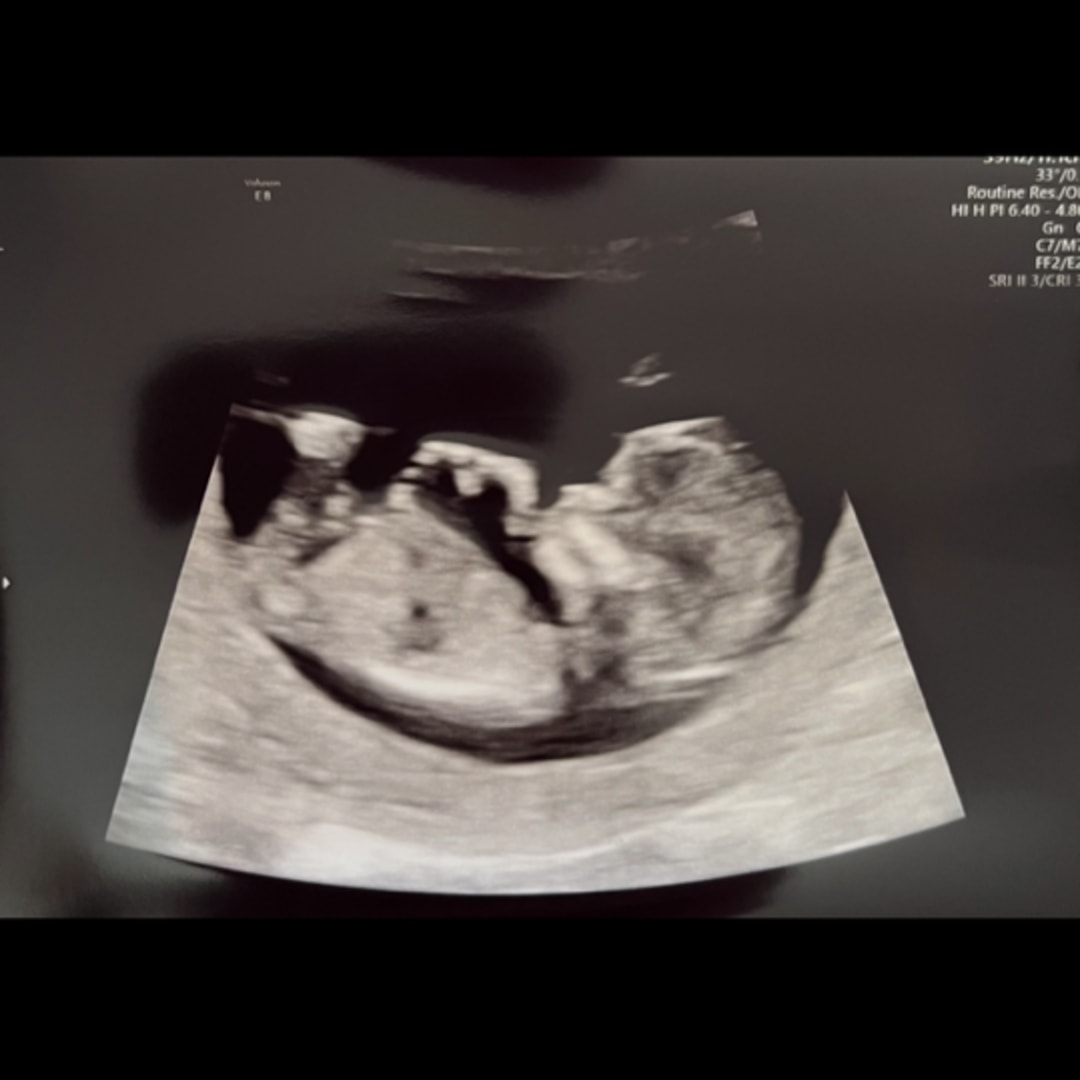 Photo shared by Shannon for their Babylist baby registry.