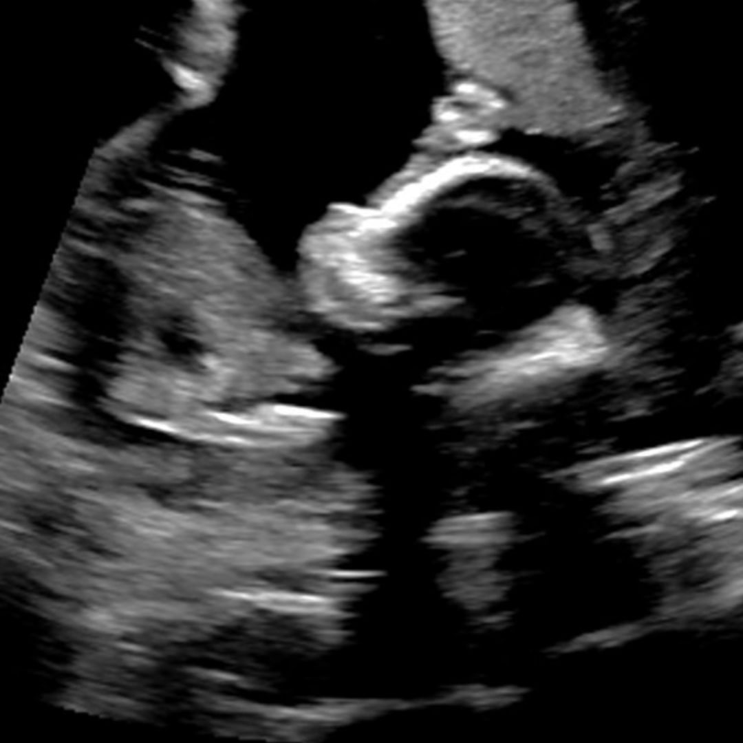 Photo shared by Annsley for their Babylist baby registry.