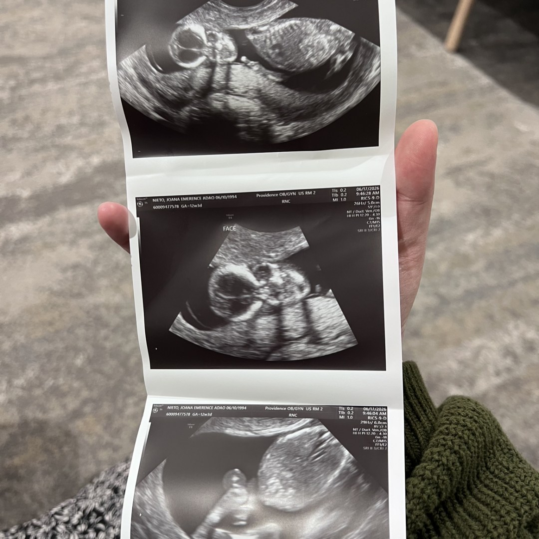 Photo shared by Joana for their Babylist baby registry.