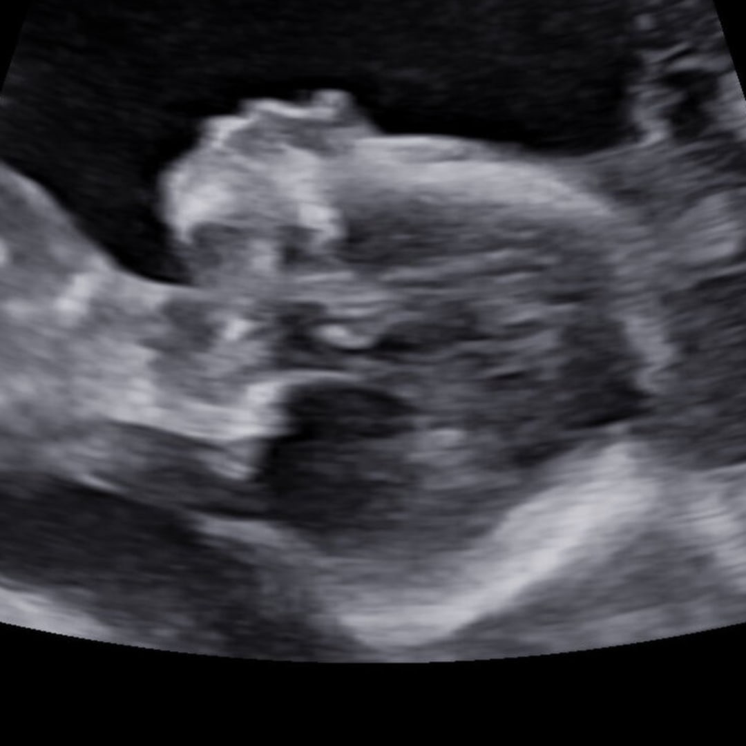 Photo shared by Aleena for their Babylist baby registry.