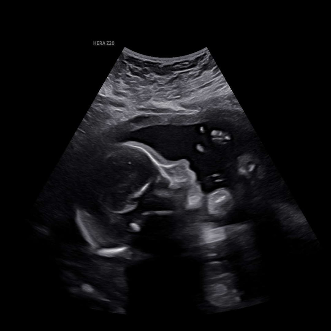 Photo shared by Samantha for their Babylist baby registry.