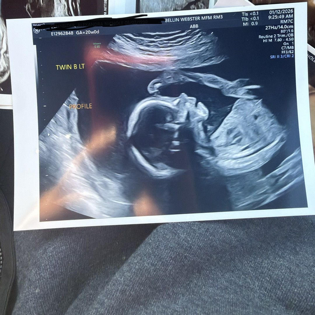 Photo shared by Alexandra for their Babylist baby registry.