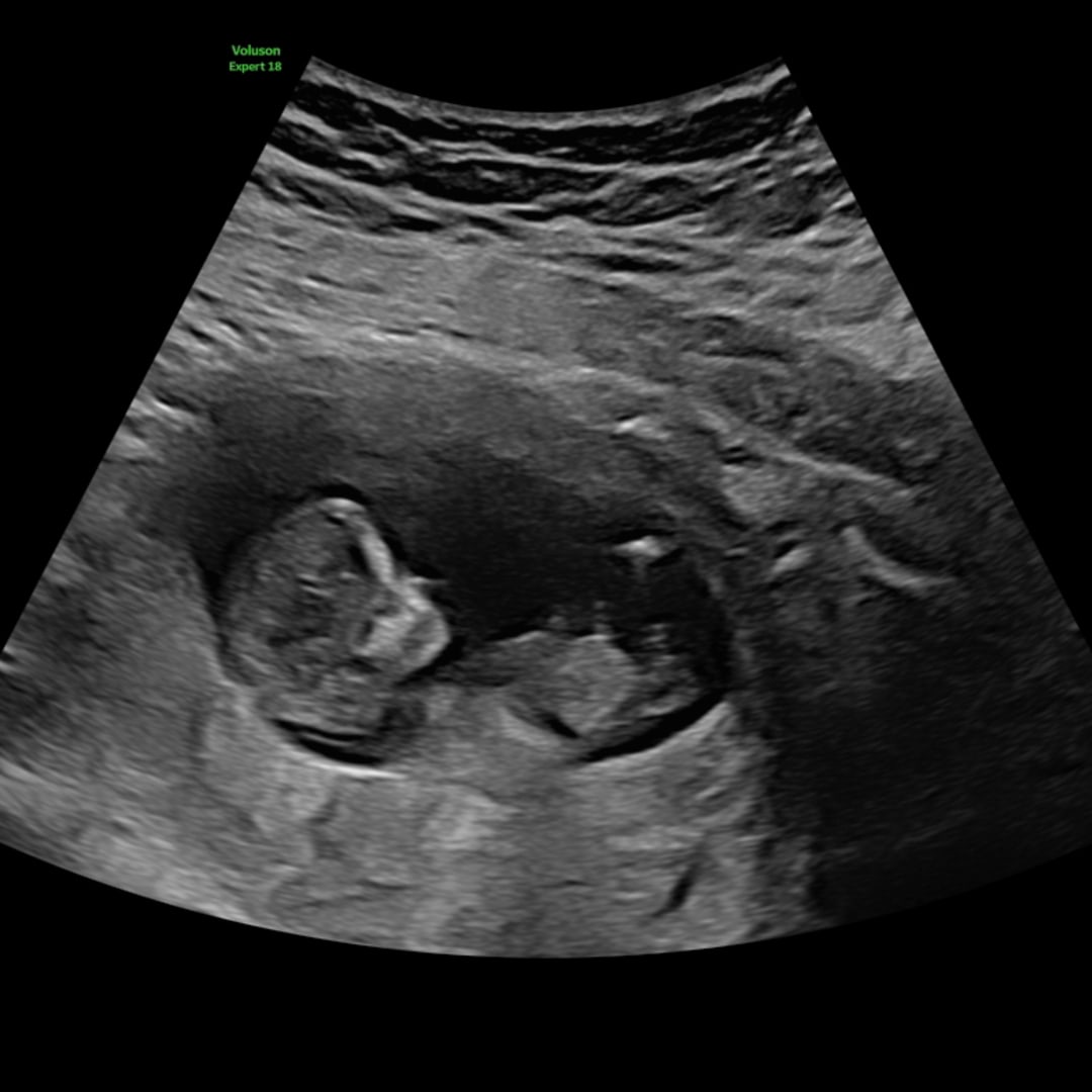 Photo shared by Elissa for their Babylist baby registry.