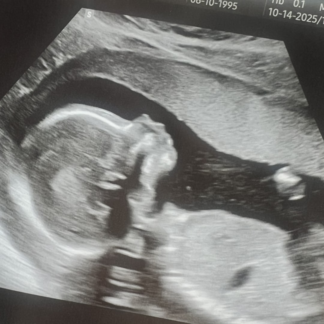 Photo shared by Bianca for their Babylist baby registry.