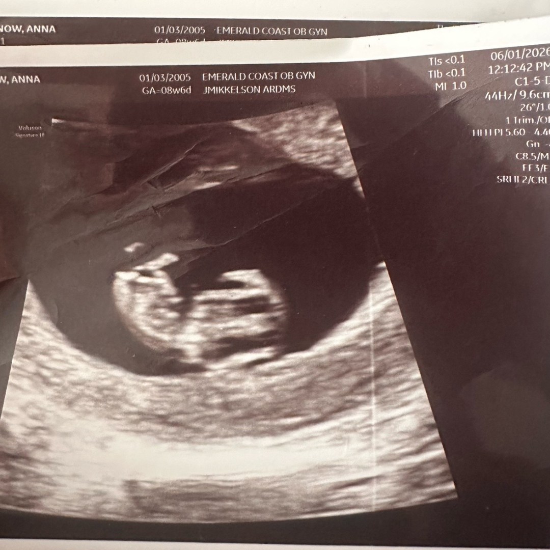 Photo shared by Anna for their Babylist baby registry.